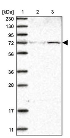 Anti-ZNF846 Antibody