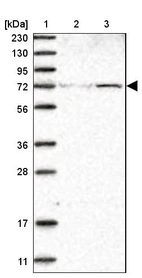 Lane 1: Marker [kDa] 230, 130, 95, 72, 56, 36, 28, 17, 11_br/_Lane 2: Human cell line RT-4_br/_Lane 3: Human cell line U-251MG sp