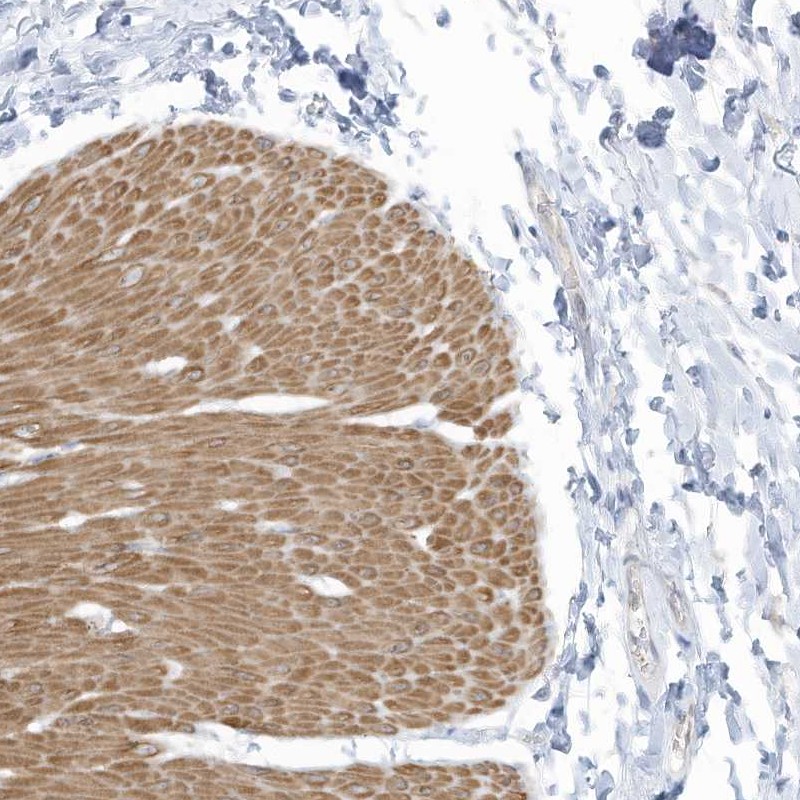 Anti-ZNF846 Antibody