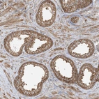 Immunohistochemical staining of human prostate shows moderate positivity in cytoplasm granular in glandular cells.