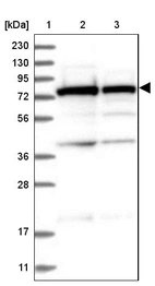 Lane 1: Marker [kDa] 230, 130, 95, 72, 56, 36, 28, 17, 11_br/_Lane 2: Human cell line RT-4_br/_Lane 3: Human cell line U-251MG sp