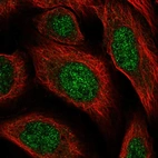 Immunofluorescent staining of human cell line U-2 OS shows localization to nucleoplasm.