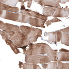 Immunohistochemical staining of human skeletal muscle shows moderate cytoplasmic positivity in striated muscle fibers.