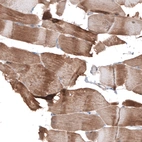 Immunohistochemical staining of human skeletal muscle shows moderate cytoplasmic positivity in striated muscle fibers.