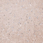 Immunohistochemical staining of human cerebral cortex shows moderate positivity in neuropil.