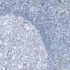Immunohistochemical staining of human tonsil shows no positivity in lymphoid cells as expected.