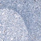 Immunohistochemical staining of human tonsil shows no positivity in lymphoid cells as expected.