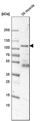 Western blot analysis in human skeletal muscle tissue.