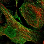 Immunofluorescent staining of human cell line U-2 OS shows localization to nucleoplasm, cytosol & actin filaments.