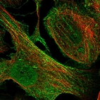 Immunofluorescent staining of human cell line U-2 OS shows localization to nucleoplasm, cytosol & actin filaments.