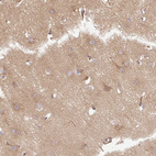 Anti-DCTN1 Antibody