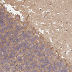 Immunohistochemical staining of human Cerebellum shows weak cytoplasmic positivity in Purkinje cells.