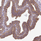 Immunohistochemical staining of human Fallopian tube shows strong membranous and cytoplasmic positivity in glandular cells.