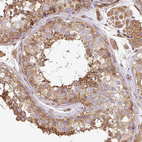 Immunohistochemical staining of human Testis shows moderate cytoplasmic positivity in cells in seminiferous ducts and leydig cells.