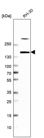 Western blot analysis in human cell line RH-30.