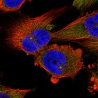 Immunofluorescent staining of human cell line U-251 MG shows localization to cytosol & centrosome.
