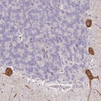 Anti-NCKAP5 Antibody