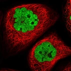 Immunofluorescent staining of human cell line A-431 shows localization to nucleoplasm.