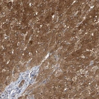 Anti-APLF Antibody