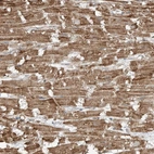 Immunohistochemical staining of human heart muscle shows strong cytoplasmic granular positivity in cardiomyocytes.