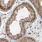 Immunohistochemical staining of human testis shows strong cytoplasmic granular positivity in cells in seminiferous ducts.