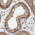 Immunohistochemical staining of human testis shows strong cytoplasmic granular positivity in cells in seminiferous ducts.