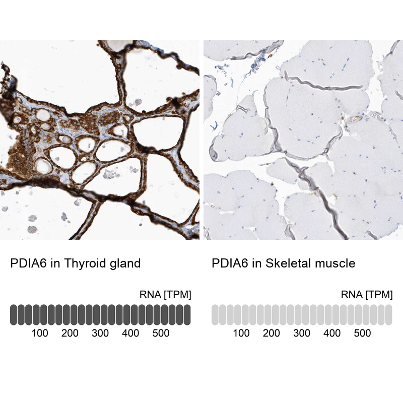 Anti-PDIA6 Antibody
