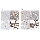 Immunohistochemical staining of human cerebral cortex, endometrium, skeletal muscle and thyroid gland using Anti-PDIA6 antibody HPA034652 (A) shows similar protein distribution across tissues to independent antibody HPA034653 (B).