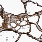 Immunohistochemical staining of human thyroid gland shows strong cytoplasmic positivity in glandular cells.
