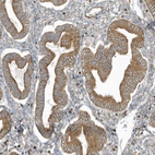 Immunohistochemical staining of human endometrium shows moderate cytoplasmic positivity in glandular cells.