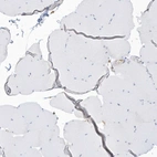 Immunohistochemical staining of human skeletal muscle shows no positivity in myocytes as expected.