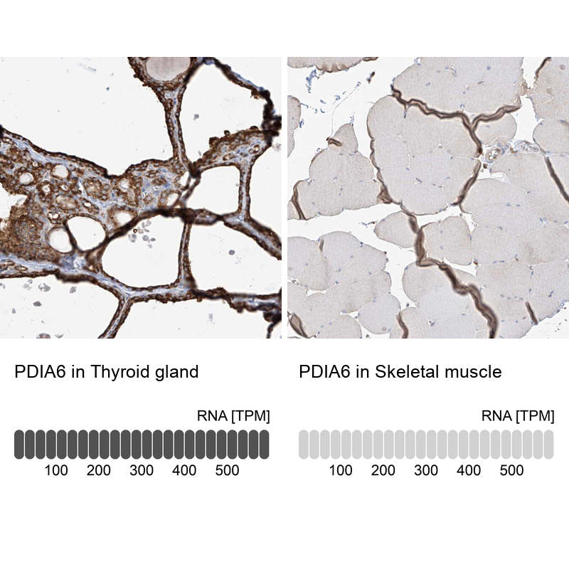 Anti-PDIA6 Antibody