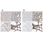 Immunohistochemical staining of human cerebral cortex, endometrium, skeletal muscle and thyroid gland using Anti-PDIA6 antibody HPA034653 (A) shows similar protein distribution across tissues to independent antibody HPA034652 (B).
