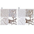 Immunohistochemical staining of human cerebral cortex, endometrium, skeletal muscle and thyroid gland using Anti-PDIA6 antibody HPA034653 (A) shows similar protein distribution across tissues to independent antibody HPA034652 (B).