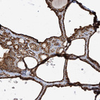 Immunohistochemical staining of human thyroid gland shows strong cytoplasmic positivity in glandular cells.