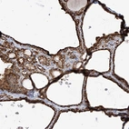 Immunohistochemical staining of human thyroid gland shows strong cytoplasmic positivity in glandular cells.