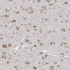 Immunohistochemical staining of human cerebral cortex shows moderate granular cytoplasmic positivity in neurons.