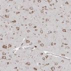 Immunohistochemical staining of human cerebral cortex shows moderate granular cytoplasmic positivity in neurons.