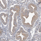 Immunohistochemical staining of human endometrium shows moderate cytoplasmic positivity in glandular cells.