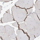 Immunohistochemical staining of human skeletal muscle shows very weak cytoplasmic positivity in myocytes.