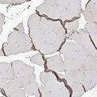 Immunohistochemical staining of human skeletal muscle shows very weak cytoplasmic positivity in myocytes.