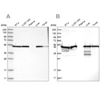 Western blot analysis using Anti-PDIA6 antibody HPA034653 (A) shows similar pattern to independent antibody HPA034652 (B).