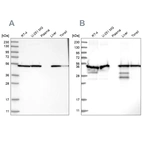 Western blot analysis using Anti-PDIA6 antibody HPA034653 (A) shows similar pattern to independent antibody HPA034652 (B).