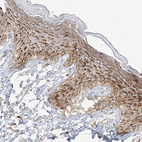 Immunohistochemical staining of human skin shows strong granular cytoplasmic positivity in squamous epithelial cells.
