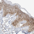 Immunohistochemical staining of human skin shows strong granular cytoplasmic positivity in squamous epithelial cells.