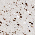 Immunohistochemical staining of human cerebral cortex shows strong granular cytoplasmic positivity in neurons.