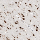 Immunohistochemical staining of human cerebral cortex shows strong granular cytoplasmic positivity in neurons.