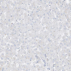 Immunohistochemical staining of human liver shows no positivity in hepatocytes as expected.