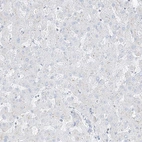 Immunohistochemical staining of human liver shows no positivity in hepatocytes as expected.