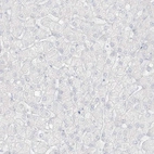 Immunohistochemical staining of human liver shows no positivity in hepatocytes as expected.
